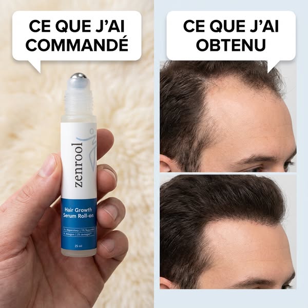 Sérum Roll-On Anti-Chute et Repousse