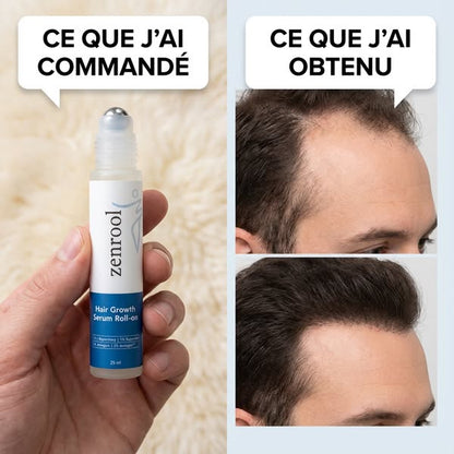 Sérum Roll-On Anti-Chute et Repousse