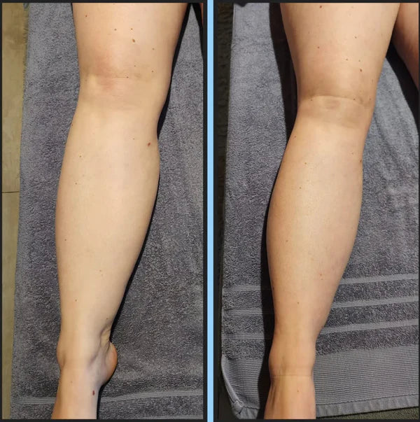 Drainage Lymphatique Liquide – Visage Affiné, Jambes Légères, Ventre Plat