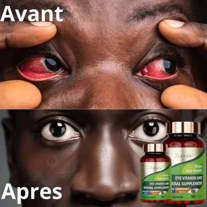 Supplément de vitamines et de lutéine pour la santé maculaire