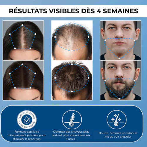 Sérum Roll-On Anti-Chute et Repousse