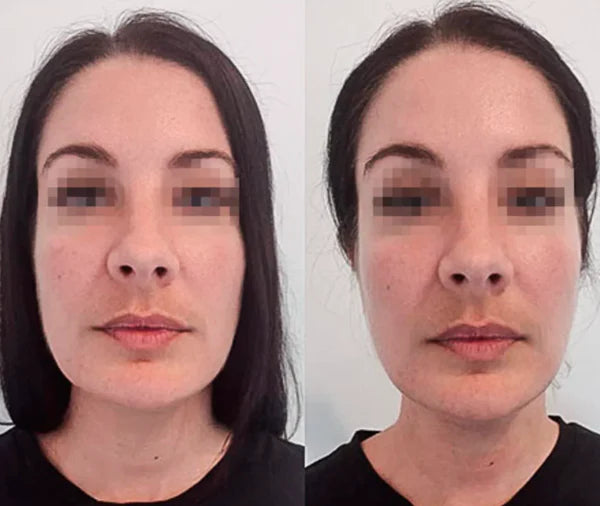 Drainage Lymphatique Liquide – Visage Affiné, Jambes Légères, Ventre Plat