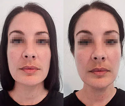 Drainage Lymphatique Liquide – Visage Affiné, Jambes Légères, Ventre Plat